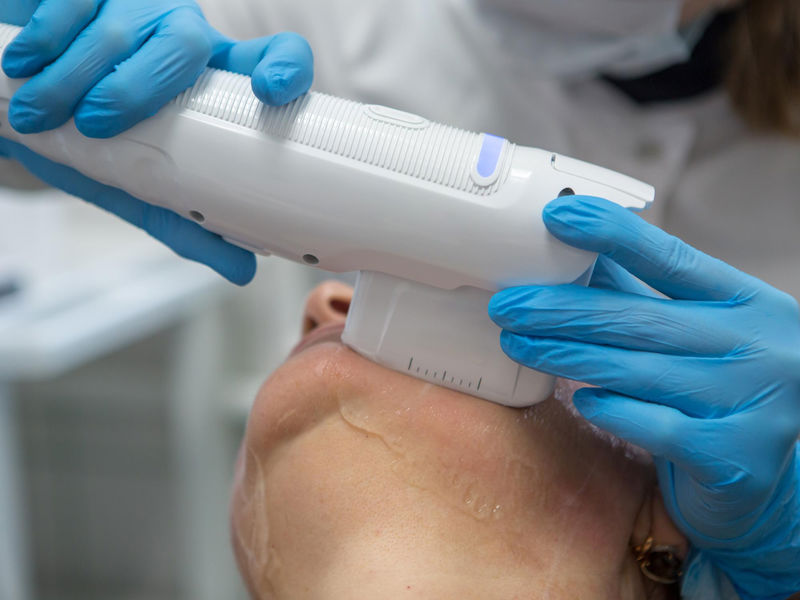 טיפול לייזר לאקנה